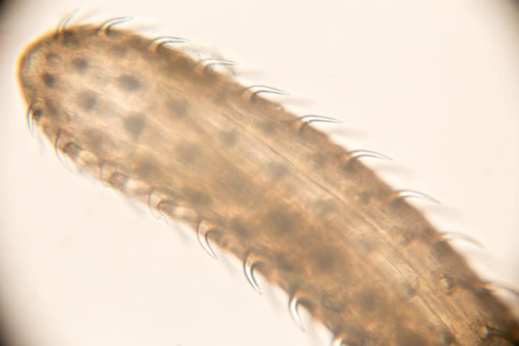 spiny headed worm