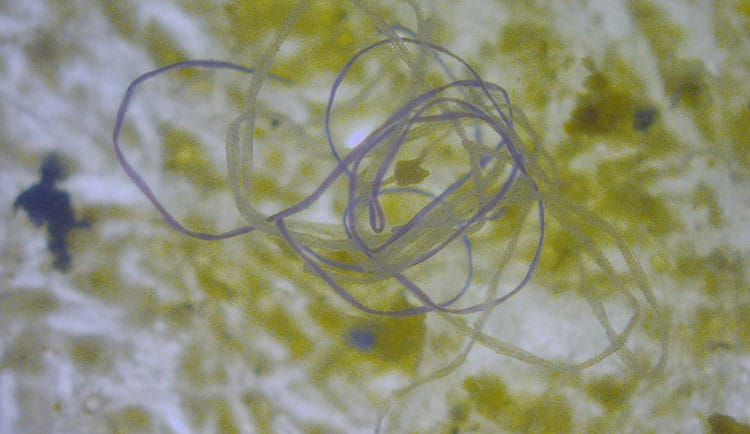 Microplastic fibres and algae.