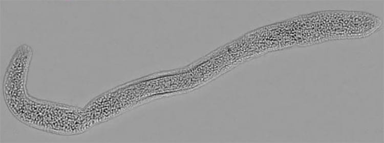 A Mature Buddenbrockia; From Myxozoa by Alexander Gruhl