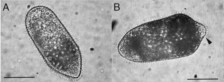 Two female Rhopalura xenoturbellaria