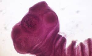 Head (scolex) of Taenia solium