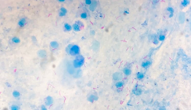 mycobacterium example of a firmacute