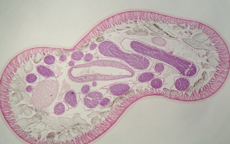 nematode worm cross section