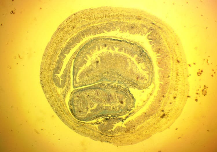proboscis worm anatomy cross section