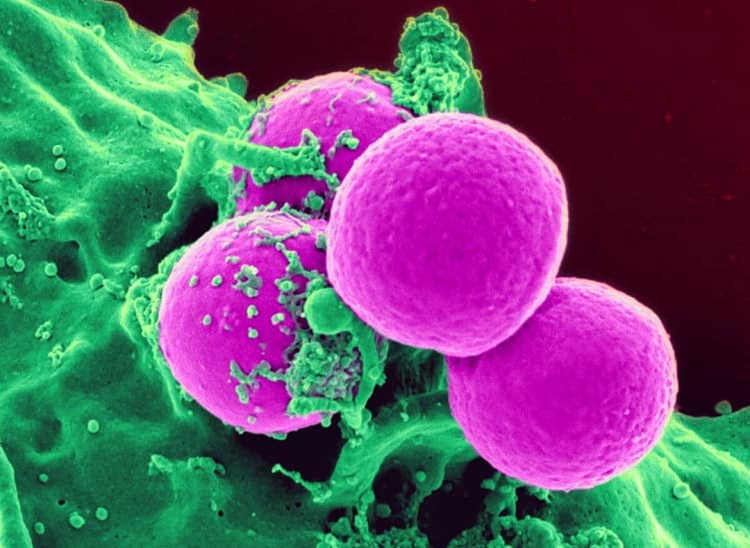 Staphylococcus bacteria